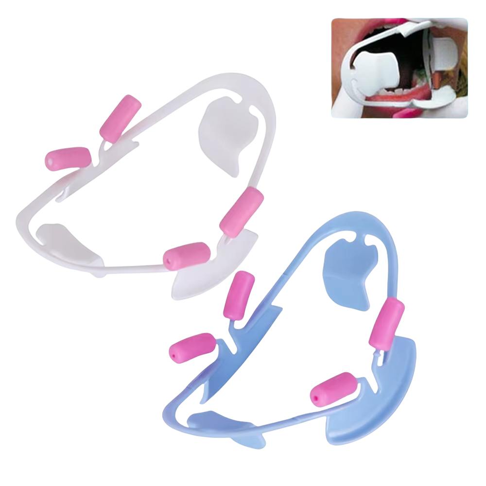 Teeth Whitening Procedure - 3D Dental Mouth Opener - Orthodontic