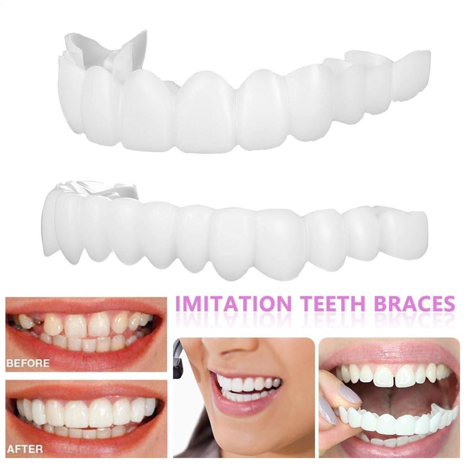 Teeth Whitening For Braces - Dental Upper Lower Fake Teeth Cover