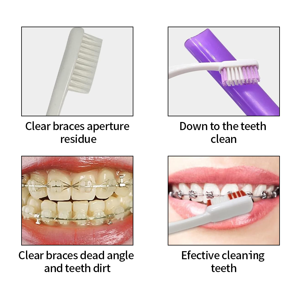 8Pcs/set Orthodontic Dental Ca - Teeth Whitening For Braces review and price