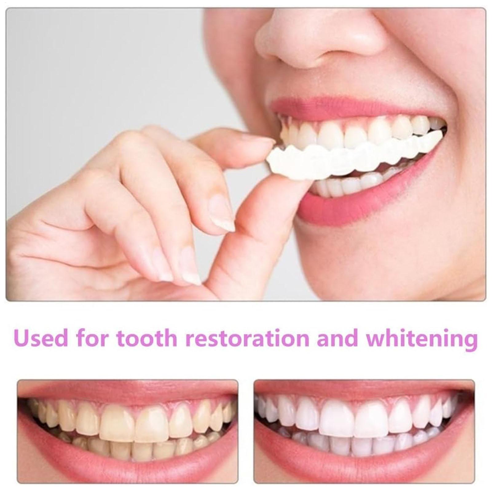 Dental Upper Lower Fake Teeth  - Teeth Whitening For Braces review and price