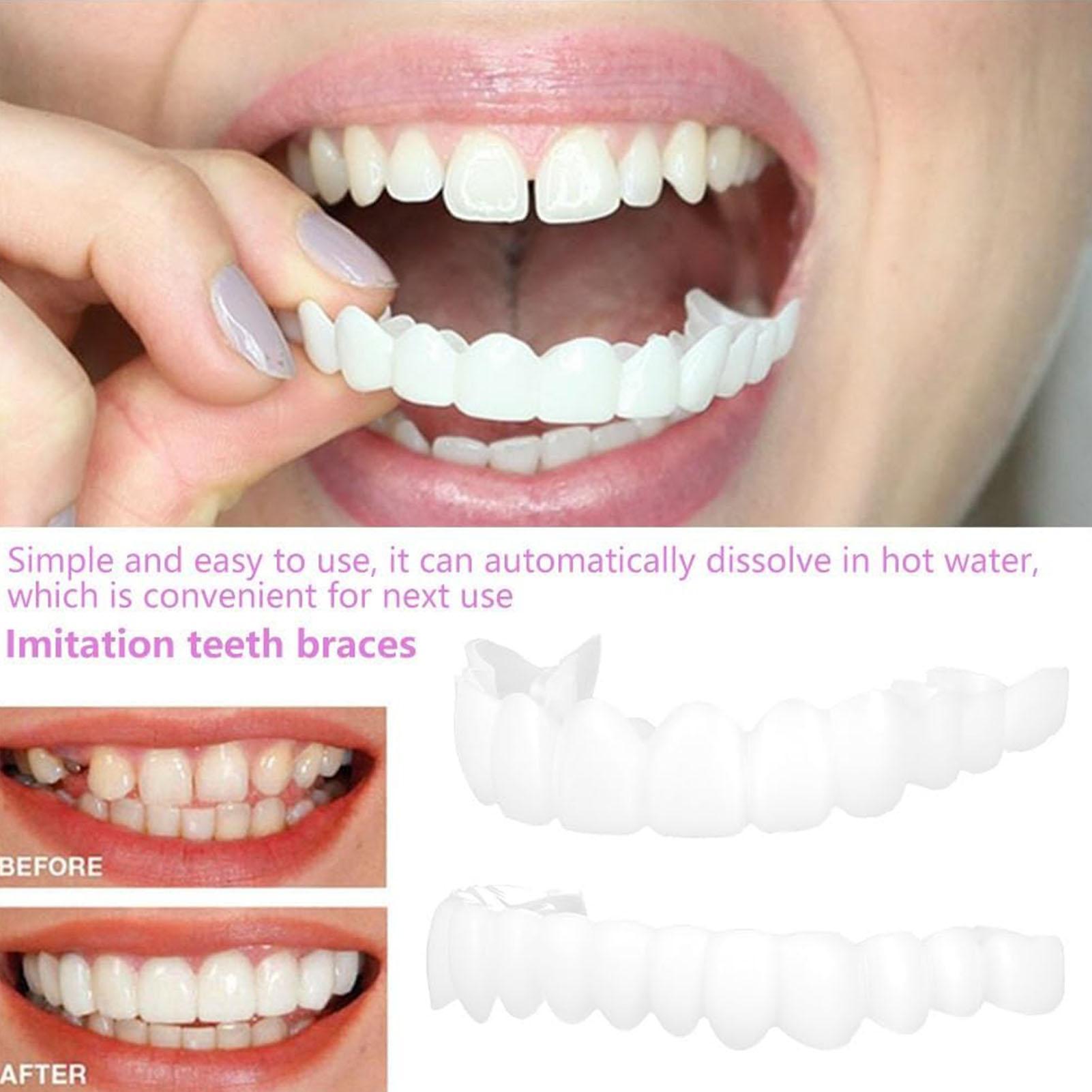 Dental Upper Lower Fake Teeth  - Teeth Whitening For Braces review and price