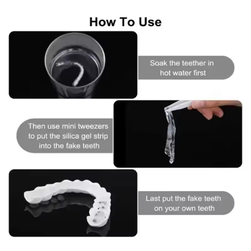 Teeth Veneers Whitening Dentur - Teeth Whitening For Braces review and price