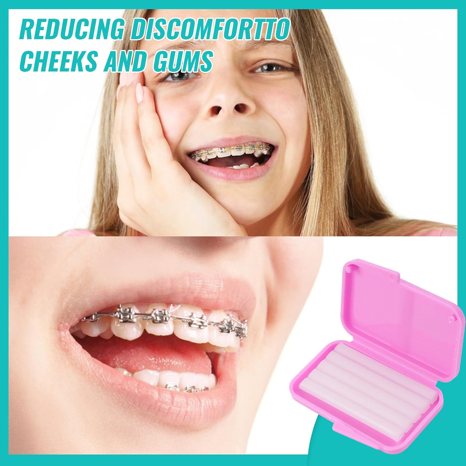 10box Dental Orthodontic Relie - Teeth Whitening For Braces review and price