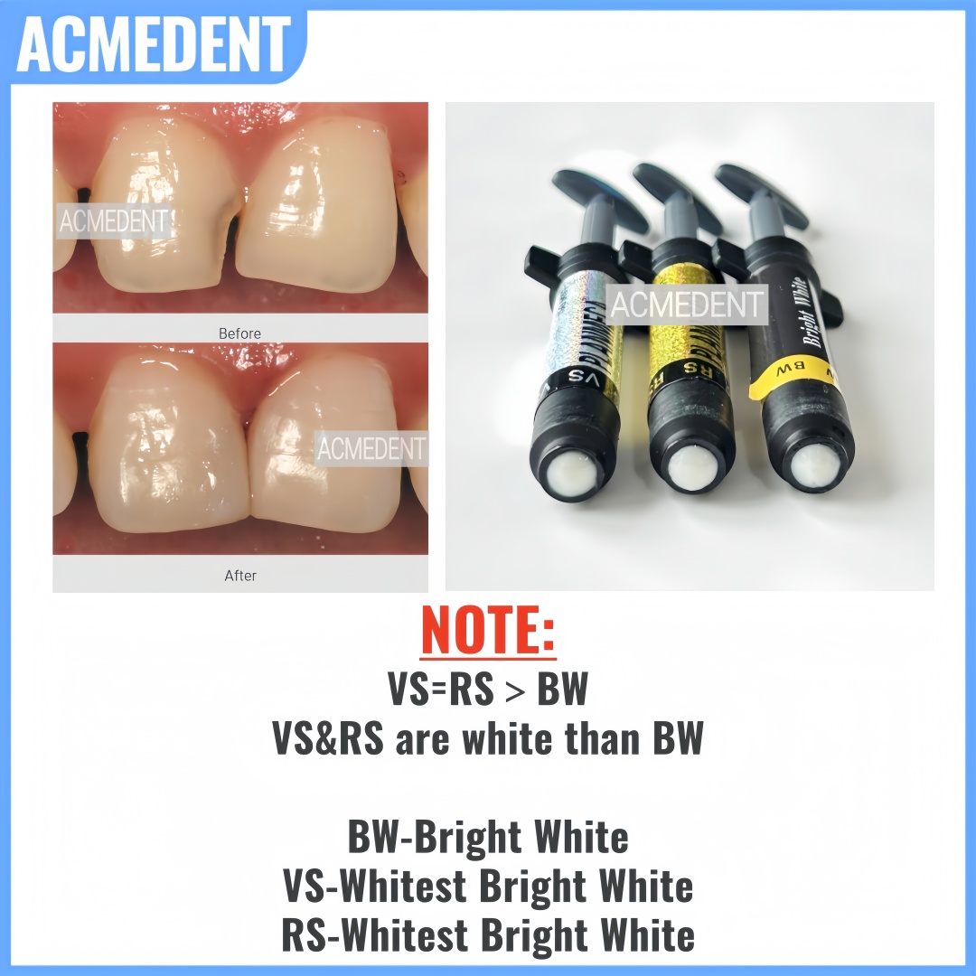 4.5g Dental Composite Resin Ve - Teeth Whitening Vs Veneers review and price
