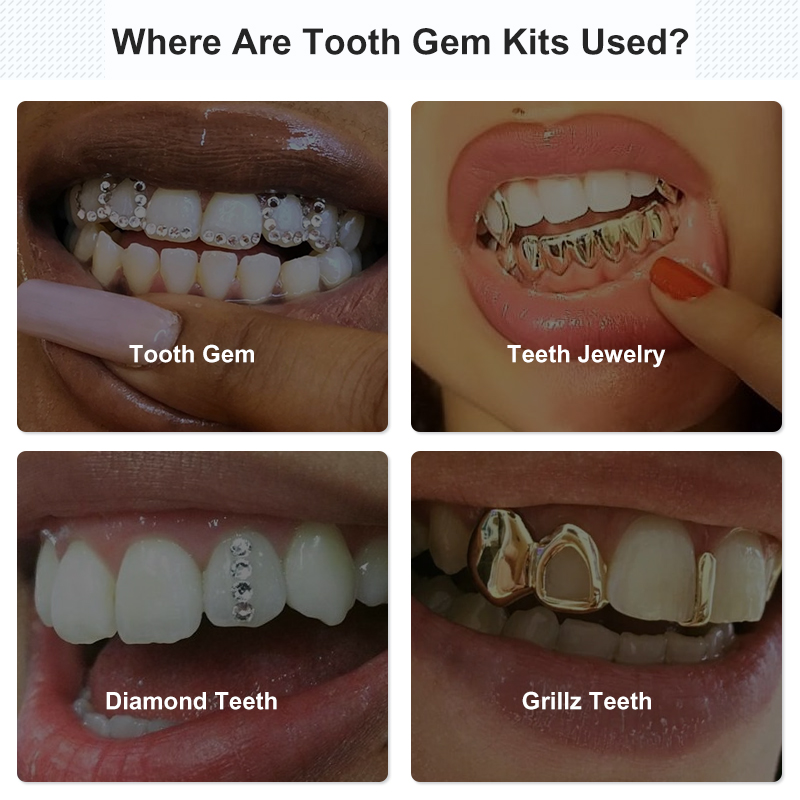 Tooth Gem Set Glue Kit with UV - Uv Whitening Kit review and price