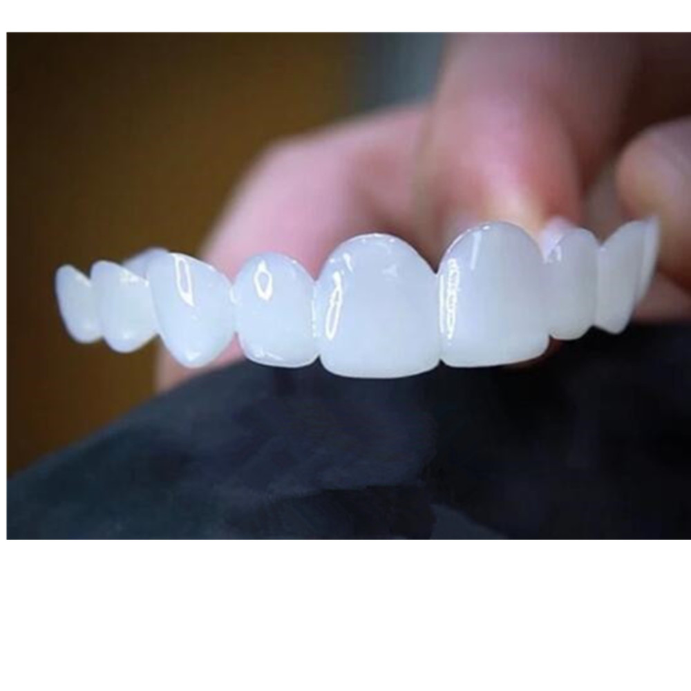 Whitening Teeth Veneers Tempor - Teeth Whitening For Braces review and price