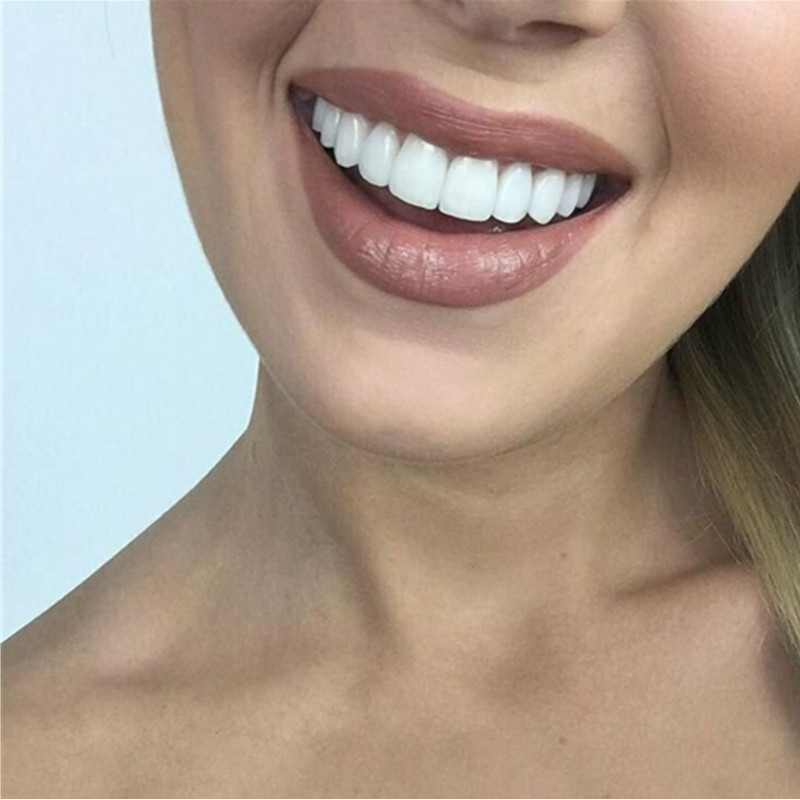 Whitening Teeth Veneers Tempor - Teeth Whitening For Braces review and price