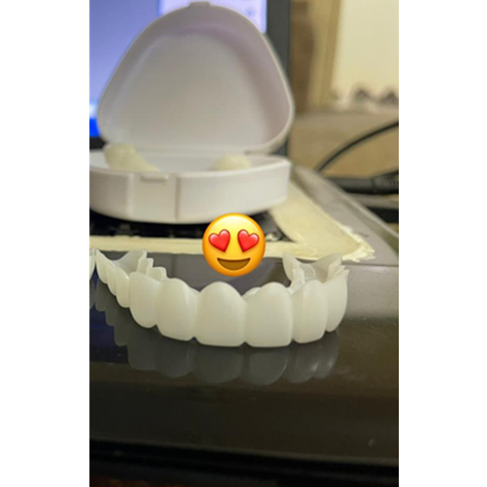 On Smile Dental Upper Lower Fa - Teeth Whitening For Braces review and price